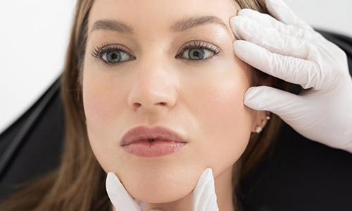 woman getting PRP PRF