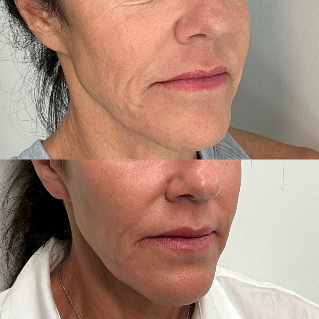 Cult Aesthetics Before and After