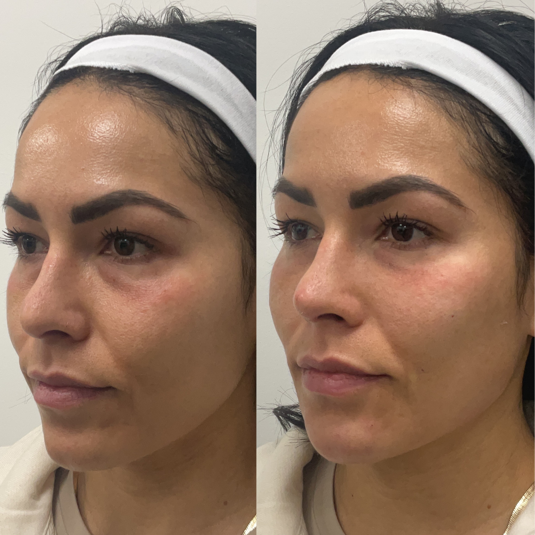 Cult Aesthetics Before and After