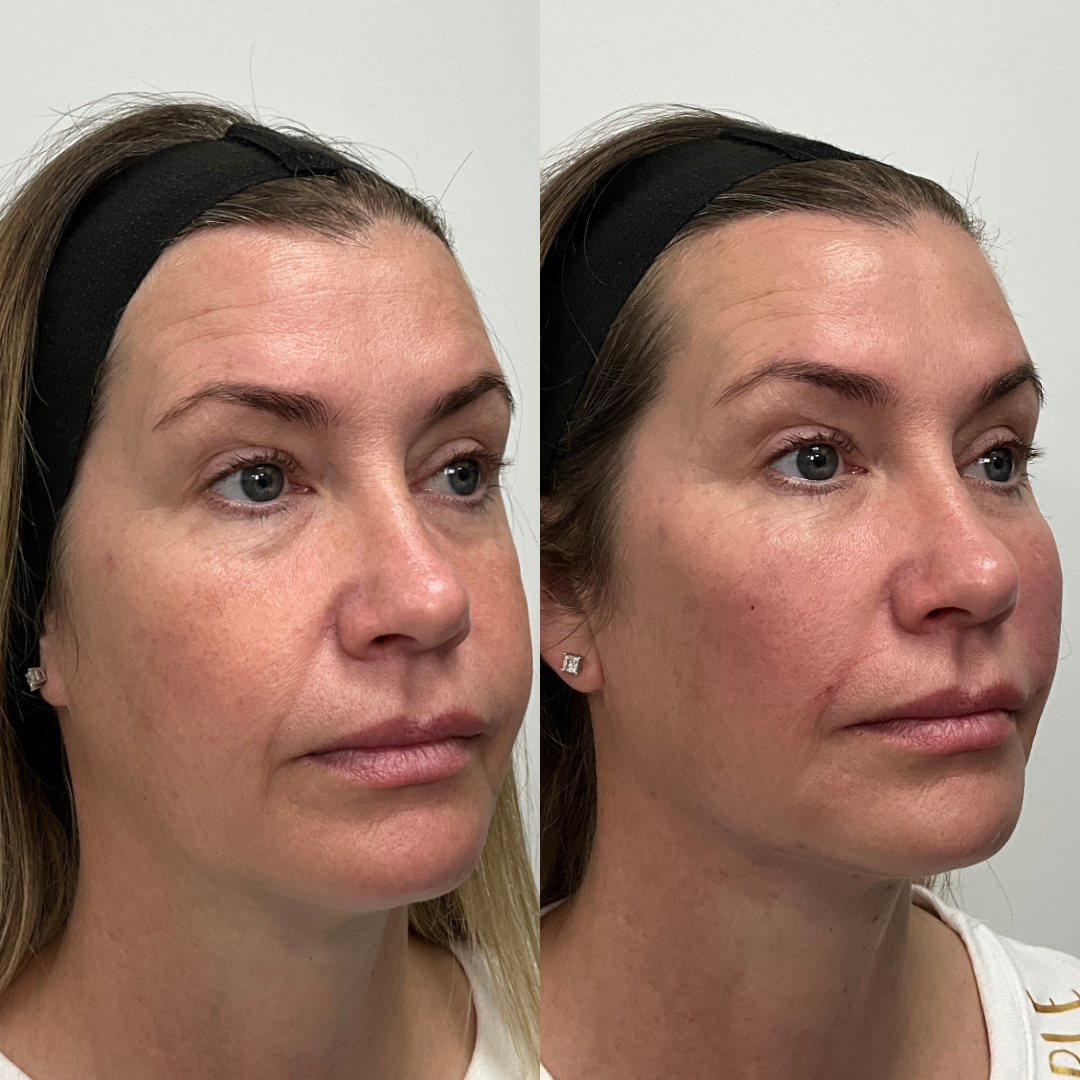 Cult Aesthetics Before and After