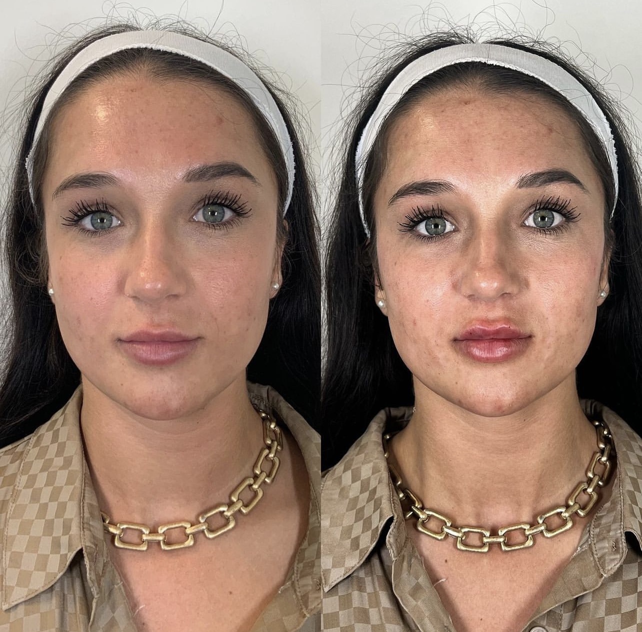 Cult Aesthetics before and after